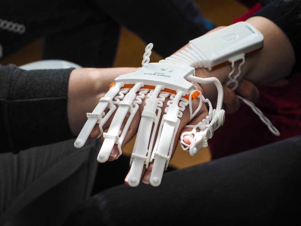 Smart Glove Detailansicht an der Hand einer Patientin